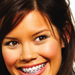 brackets-metalicos-v275x360
