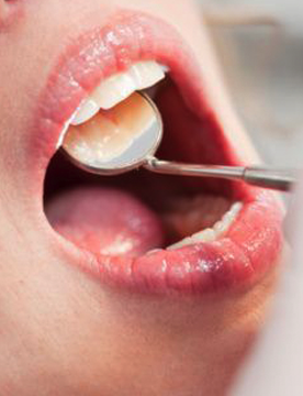 Odontologia general conservadora
