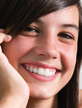 Brackets Invisalign Teen