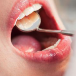 periodoncia-v275x360